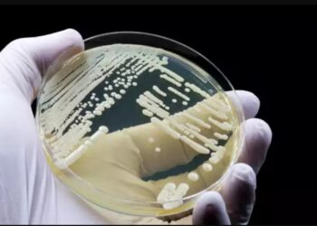 Συναγερμός και στην Ελλάδα για τον μύκητα Candida auris-Γιατί ανησυχεί τόσο πολύ τους ειδικούς