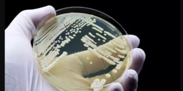 Alldaynews.gr Συναγερμός και στην Ελλάδα για τον μύκητα Candida auris-Γιατί ανησυχεί τόσο πολύ τους ειδικούς