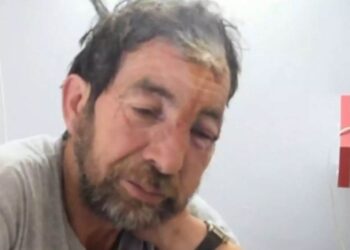 Alldaynews.gr Φθιώτιδα: Αυτός είναι ο βοσκός που δέχθηκε επίθεση από αρκούδα στη Μακρακώμη