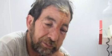 Alldaynews.gr Φθιώτιδα: Αυτός είναι ο βοσκός που δέχθηκε επίθεση από αρκούδα στη Μακρακώμη