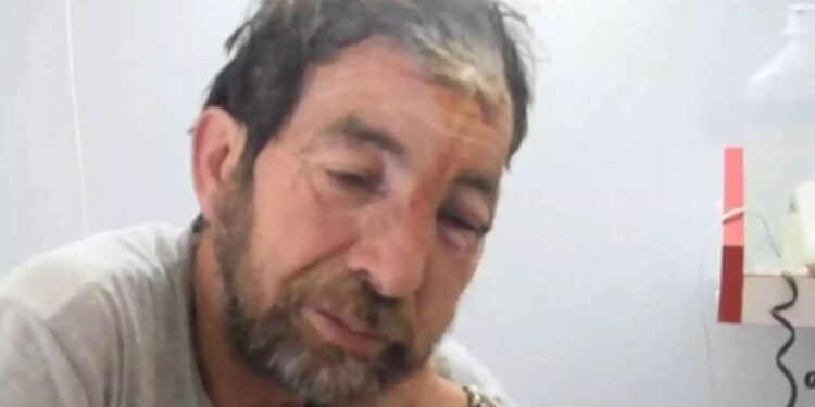 Alldaynews.gr Φθιώτιδα: Αυτός είναι ο βοσκός που δέχθηκε επίθεση από αρκούδα στη Μακρακώμη