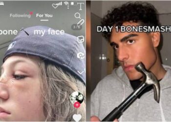 Άκρως επικίνδυνη η νέα τάση στο TikTok: “Έφηβοι σπάνε τα κόκκαλα του προσώπου τους”