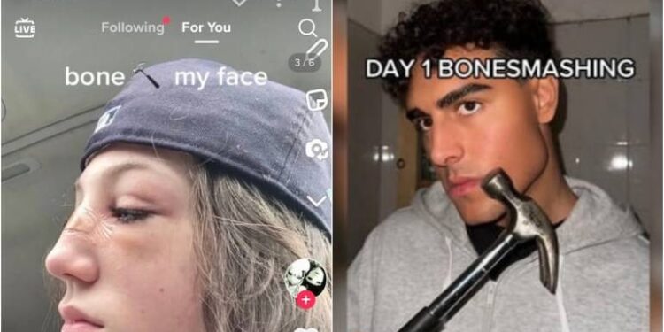 Άκρως επικίνδυνη η νέα τάση στο TikTok: “Έφηβοι σπάνε τα κόκκαλα του προσώπου τους”