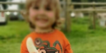 Alldaynews.gr 2χρονος πήγε στα επείγοντα λόγω γρίπης και του αφαίρεσαν όγκο απο τον εγκέφαλο!