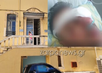 Προσπάθησε να του ξεριζώσει τα μάτια – «Ένιωσα το δάχτυλο να μπαίνει στο κρανίο μου»