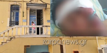 Προσπάθησε να του ξεριζώσει τα μάτια – «Ένιωσα το δάχτυλο να μπαίνει στο κρανίο μου»