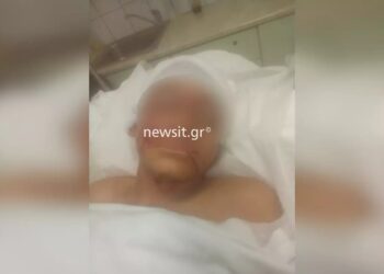 Επίθεση πίτμπουλ σε 11χρονο στην Αρτέμιδα: «Πρόκειται για απόπειρα δολοφονίας του παιδιού!»