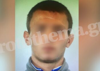 Εξάρχεια: Αυτός είναι ο άνδρας που επιτέθηκε σε γυναίκες – Δείτε φωτογραφία