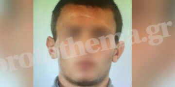 Εξάρχεια: Αυτός είναι ο άνδρας που επιτέθηκε σε γυναίκες – Δείτε φωτογραφία