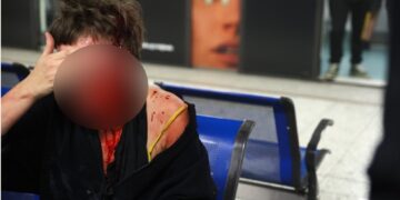 Alldaynews.gr ΠΡΙΝ ΑΠΟ ΛΙΓΟ: Η στιγμή της άγριας επίθεσης ακροδεξιών σε βαγόνι του ΗΣΑΠ (video)