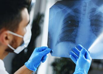 Υγιή πνευμόνια: Οι 4 βιταμίνες που δεν πρέπει να λείψουν από τη διατροφή σας