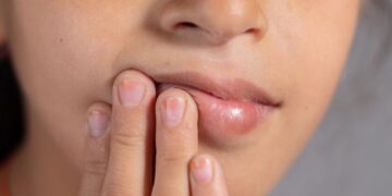 Alldaynews.gr Καρδιακή προσβολή: Αυξημένος κίνδυνος αν συμβαίνει αυτό στο στόμα σας