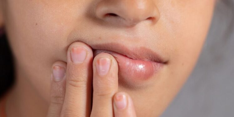 Alldaynews.gr Καρδιακή προσβολή: Αυξημένος κίνδυνος αν συμβαίνει αυτό στο στόμα σας