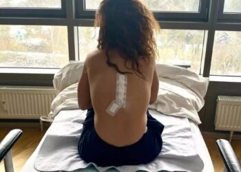 Συγκλονίζει η Γιάννα Τερζή: «Τρία χρόνια πριν διαγνώστηκα με όγκο στο νωτιαίο μυελό» (φωτο, video)