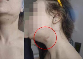 Την χτύπησε και πήγε να την πνίξει επειδή δεν θα έκαναν μαζί Πρωτοχρονιά – «Πήδηξα από το μπαλκόνι για να σωθώ» λέει η 28χρονη