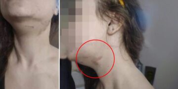 Την χτύπησε και πήγε να την πνίξει επειδή δεν θα έκαναν μαζί Πρωτοχρονιά – «Πήδηξα από το μπαλκόνι για να σωθώ» λέει η 28χρονη