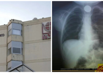 Σώθnκε από θαúμα: Κέρμα σφηνώθnκε στον λαıμό 4χρоνоυ ανήμερα Πρωτοχρονιάς