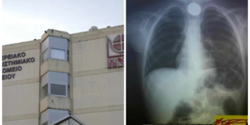 Σώθnκε από θαúμα: Κέρμα σφηνώθnκε στον λαıμό 4χρоνоυ ανήμερα Πρωτοχρονιάς