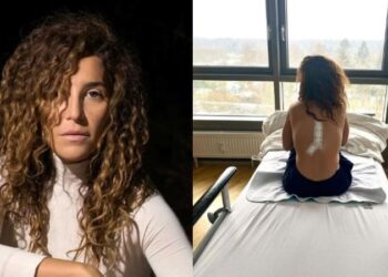 Γιάννα Τερζή: «Ήμουν τυχερή που ο γιατρός δεν με άφησε παράλυτη» – Η συγκλονιστική εξομολόγηση για τον όγκο στον νωτιαίο μυελό