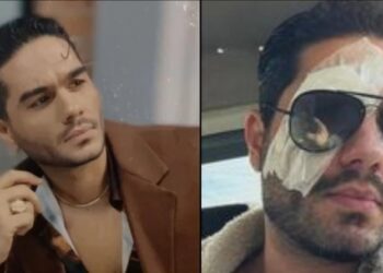 Σοκάρουν οι φωτογραφίες με τα μάτια του Χρήστου Μάστορα: «Αιτία ο covid ο άτιμος… ψάξτε το» (φωτο)