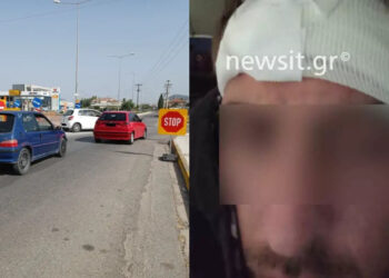 O ντελιβεράς που του δάγκωσαν το αυτί για μια προσπέραση: «Έκοψε κομμάτι, το είδα στο στόμα του και μετά στο έδαφος» (φωτο, video)