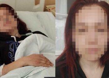 Άγριος ξυλοδαρμός γυναίκας πρώην bodybuilder από τον σύζυγό της – «Προσπάθησε να με πνίξει»