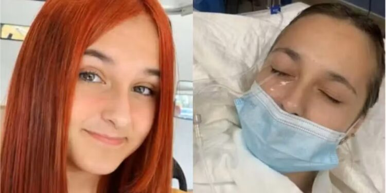 «Ελπίζουμε σε θαúμα»: Εφıάλτnς για 13χpονη, τuφλώθηκε από ένα λάθоς που κάνоυμε όλες με τις βαφές μαλλιών