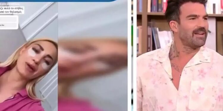 Η Ιωάννα Τούνη έκανε πλαστική στήθους -Επική ατάκα από Αλεξάνδρου: «Έγινε εργονομικό, από δυάρι τριάρι»