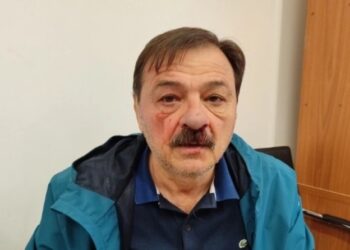 Μασκοφόρος ξυλοκόπησε δημοτικό σύμβουλο: Τον κυνήγησαν και έπαθαν… πλάκα όταν του έβγαλαν την κουκούλα (φωτο)