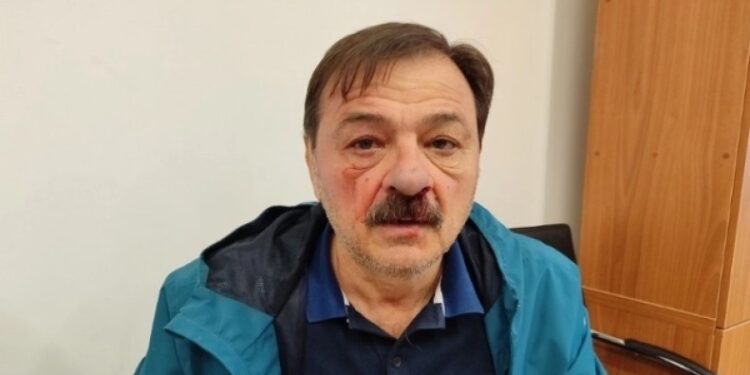 Μασκοφόρος ξυλοκόπησε δημοτικό σύμβουλο: Τον κυνήγησαν και έπαθαν… πλάκα όταν του έβγαλαν την κουκούλα (φωτο)