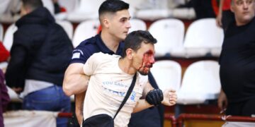 Alldaynews.gr Σοβαρά επεισόδια στο Νήαρ Ηστ – Τρίκαλα – Οπαδοί αποχώρησαν αιμόφυρτοι από το γήπεδο (φωτο)