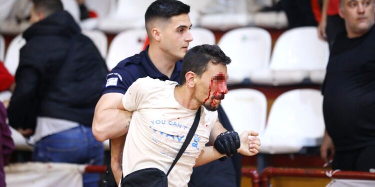 Alldaynews.gr Σοβαρά επεισόδια στο Νήαρ Ηστ – Τρίκαλα – Οπαδοί αποχώρησαν αιμόφυρτοι από το γήπεδο (φωτο)