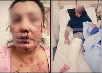 Αιγάλεω: «Παραλίγο να σκοτωθούμε» – Το ζευγάρι που δέχθηκε επίθεση στη μέση του δρόμου περιγράφει τον εφιάλτη