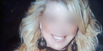 Δεύτερος θάνατος γυναίκας μετά από λιποαναρρόφηση μετά την 57χρονη Χαρά