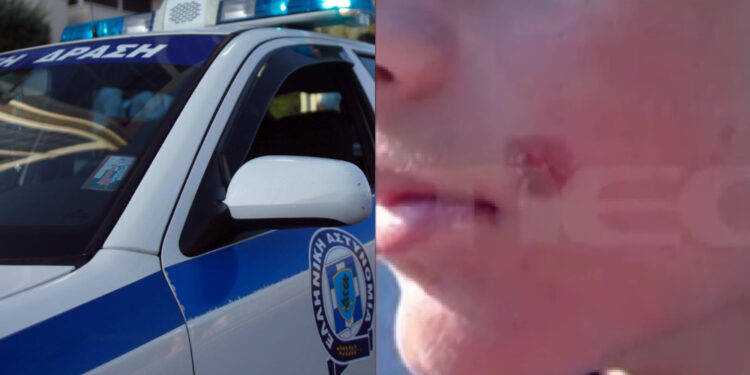 Ανελέητο bullying από συμμορία ανηλίκων – «Φοβάμαι μην καταλήξω όπως ο Άλεξ» λέει θύμα τους (video)