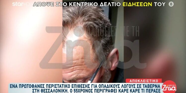 Alldaynews.gr Πρωτοφανές περιστατικό οπαδικής επίθεσης σε 55χρονο σε ταβέρνα: «Με έριξαν κάτω και με χτυπούσαν 20 άτομα με δολοφονικό τρόπο…