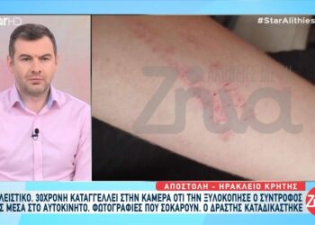 30χρονη έπεσε θύμα ξυλοδαρμού από τον σύντροφό της: Με είχε ξαναχτυπήσει και δεν είχα καλέσει την Αστυνομία…Όταν μπαίνει μπροστά ο φόβος δεν σκέφτεσαι λογικά…