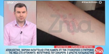 Alldaynews.gr 30χρονη έπεσε θύμα ξυλοδαρμού από τον σύντροφό της: Με είχε ξαναχτυπήσει και δεν είχα καλέσει την Αστυνομία…Όταν μπαίνει μπροστά ο φόβος δεν σκέφτεσαι λογικά…