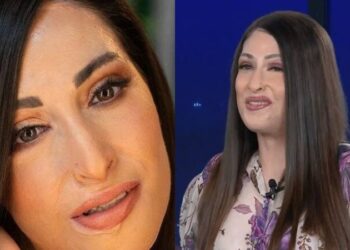 «Ράγισε» καρδιές η Ιωάννα Παλιοσπύρου: «Δεν θα αποκατασταθώ ποτέ πλήρως – Ό,τι καίγεται, χάνεται για πάντα»