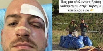 Alldaynews.gr Άγρια επίθεση στην Πάρνηθα: Νεαροί μαχαίρωσαν εθελοντές που καθάριζαν την περιοχή – «Εμείς είμαστε από το Μενίδι» φώναζαν