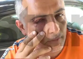 Άγριος ξυλοδαρμός ελεγκτή σε λεωφορείο – «Με δάγκωσαν, με χτυπούσαν στο κεφάλι»