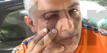 Άγριος ξυλοδαρμός ελεγκτή σε λεωφορείο – «Με δάγκωσαν, με χτυπούσαν στο κεφάλι»