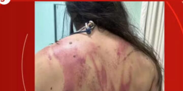 Alldaynews.gr Πατέρας χτύπησε την 33χρονη κόρη του με ματσέτα – Τσακώθηκαν για 165 ευρώ που κόστιζε η επισκευή αυτοκινήτου