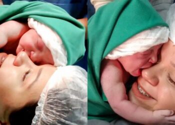Μια εικόνα χίλιες λέξεις: Νεογέννητο αγκαλιάζει σφιχτά την μαμά του δευτερόλεπτα μετά την γέννα
