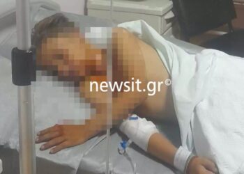 Πάτρα: «Μπαμπά, θα πεθάνω;» – Τα πρώτα λόγια του 9χρονου που δέχθηκε βεγγαλικό στον λαιμό