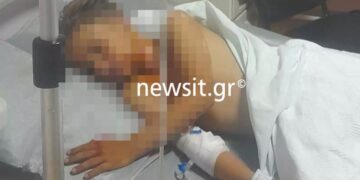 Alldaynews.gr Πάτρα: «Μπαμπά, θα πεθάνω;» – Τα πρώτα λόγια του 9χρονου που δέχθηκε βεγγαλικό στον λαιμό