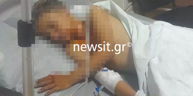 Alldaynews.gr Πάτρα: «Μπαμπά, θα πεθάνω;» – Τα πρώτα λόγια του 9χρονου που δέχθηκε βεγγαλικό στον λαιμό