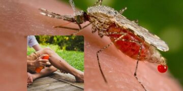 Alldaynews.gr Παγκόσμιος συναγερμός: Φόβοι για νέα πανδημία – Εντοπίστηκε ο ιός Oropouche