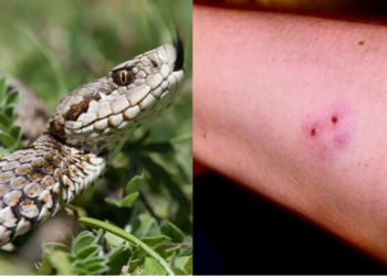 Την δάγκωσε οχιά που είχε κρυφτεί κάτω από το κρεβάτι της δίχρονης εγγονής της – Την γλίτωσε στο «παρά πέντε»