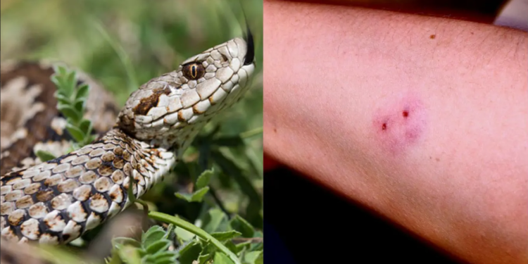 Alldaynews.gr Την δάγκωσε οχιά που είχε κρυφτεί κάτω από το κρεβάτι της δίχρονης εγγονής της – Την γλίτωσε στο «παρά πέντε»